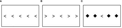A quantitative analysis of fidgeting in ADHD and its relation to performance and sustained attention on a cognitive task